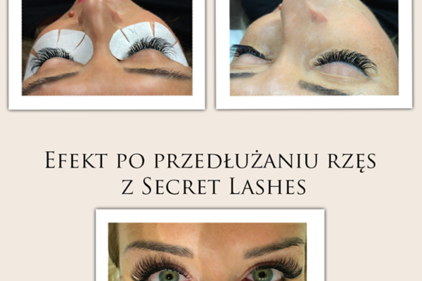 Aplikacje z zabiegów 3D 5